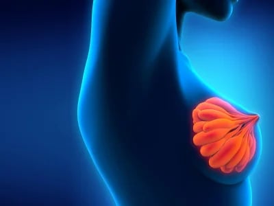 Die Zukunft der Brustchirurgie: Brustvergrößerung mit Eigenfett in Bochum
