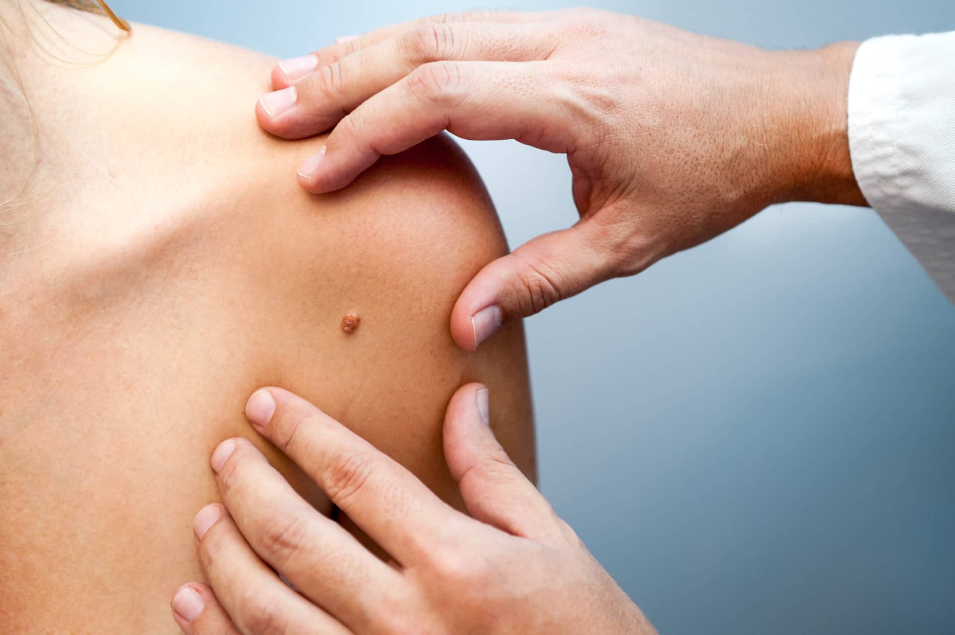 Lasertechnologie: Die sichere und wirksame Methode zur Tattooentfernung