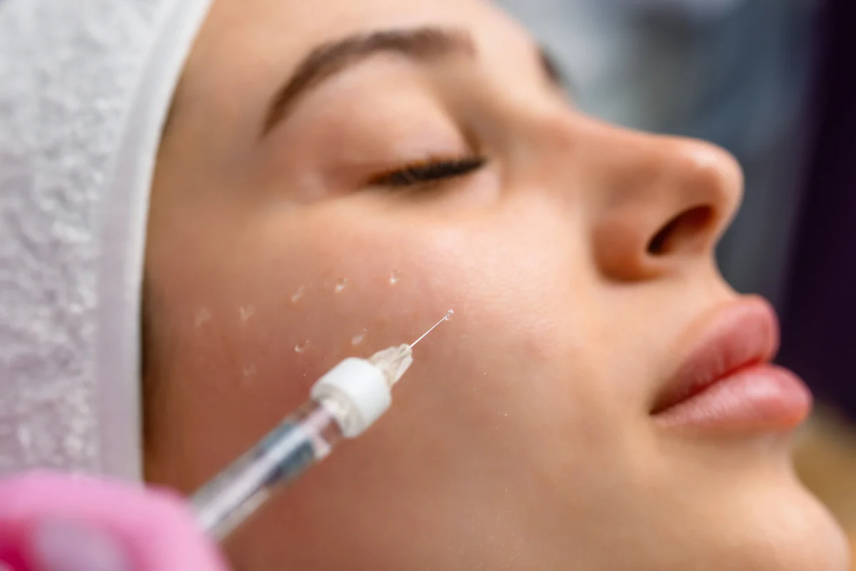 Alles über mesotherapie gesicht preise bei MorySkin erfahren
